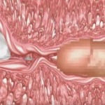 Thumbnail of post image 095