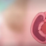 Thumbnail of post image 198