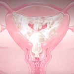 Thumbnail of post image 113