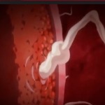 Thumbnail of post image 170